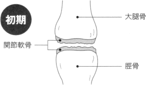 �i�C���X�g�j�G�ɂ̏���