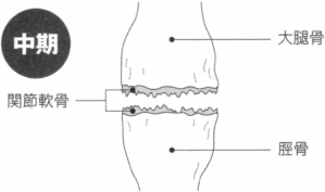 �i�C���X�g�j�G�ɂ̒���